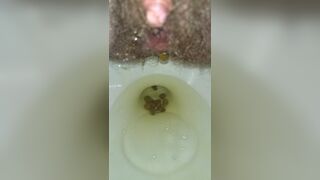 Little Balls Of Shit + Pissing Like A Broken Sprinkler, ScatKings.com Scat Porn 30 ScatKings.com Scat Porn